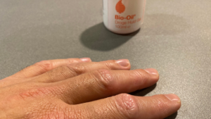 bio oil op mijn huid